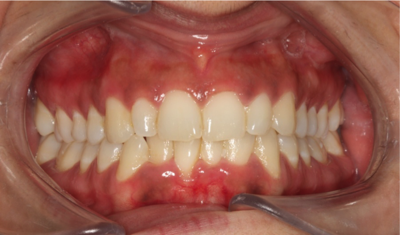 casos reales clínica dental SyS